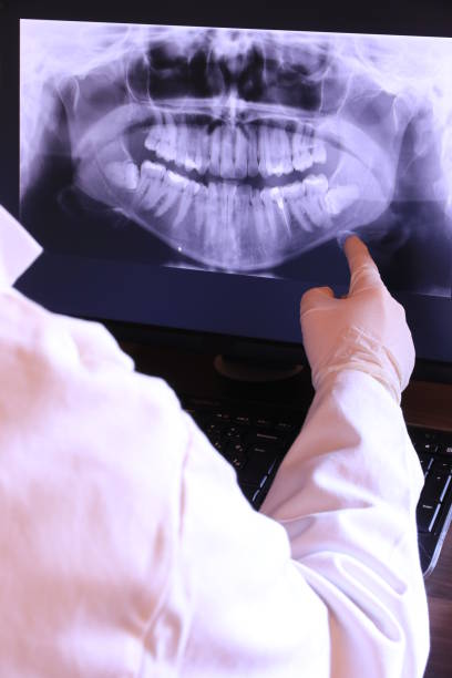 Best Emergency Tooth Extraction in Haysville, KS